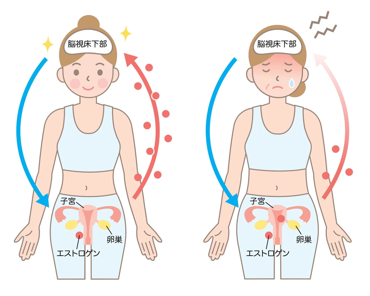 ホットフラッシュ、発汗、不眠が三大症状