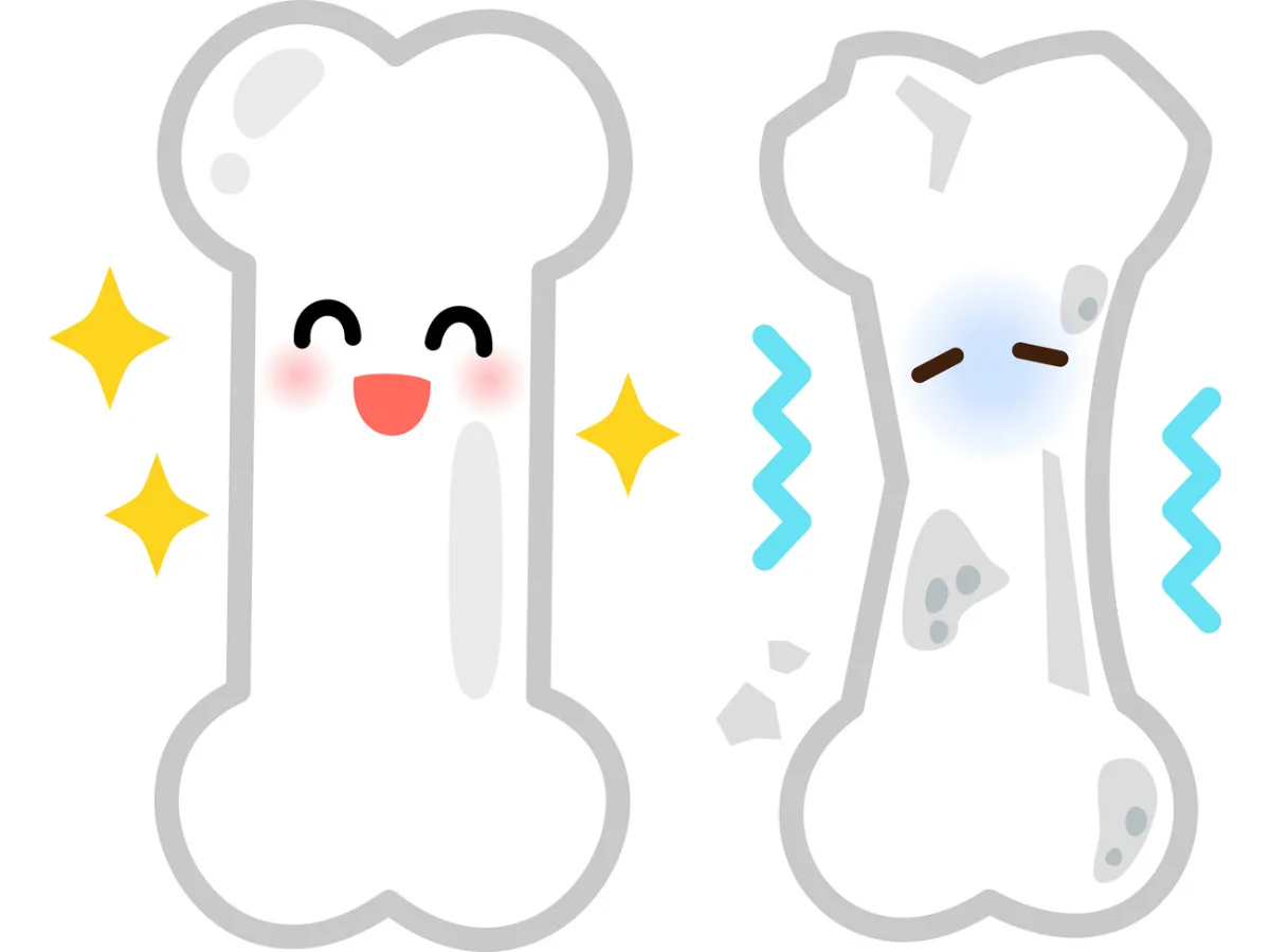 健康な骨と脆い骨のキャラクター